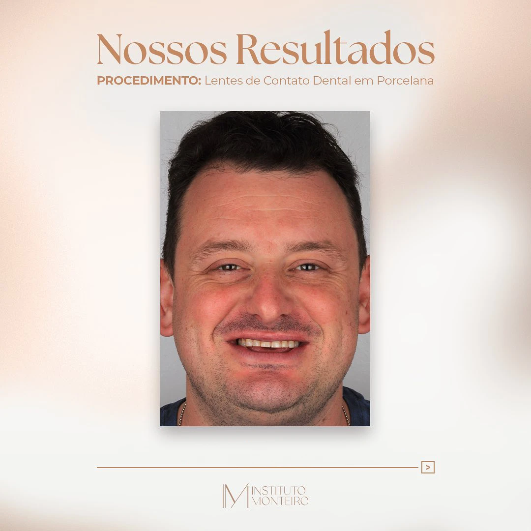Res3
